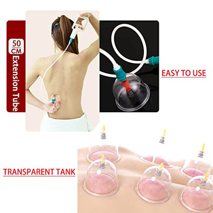 MYMM 12 Cupping Cups Sets Biomagnetic Traditional Professional Chinese Therapy Massage