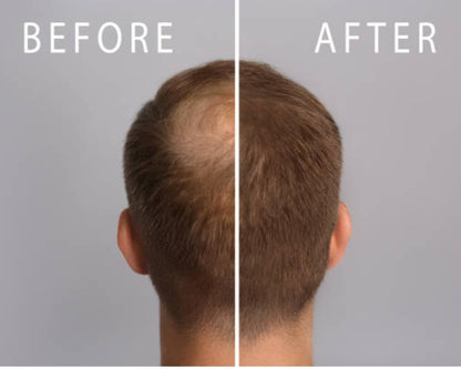 Mane Rain Hair Growth for Men and Women-Z-LAB27 BioActive Plant Formula Awakens Hibernating Roots-Stimulates and Nourishes Scalp-Blocks DHT-Fuller Thicker Hair-Made in USA
