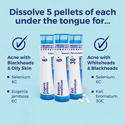 Boiron Acne Relief Kit for Blackheads, Oily Skins, Whiteheads on The Face and Body - 3 Count (240 Pellets)