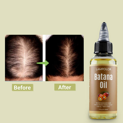 RAW Batana Oil for Hair Growth, Dr Sebi Organic Unrefined Batana Oil from Honduran, 100% Pure & Natural Hair Growth for Thicker & Stronger Hair - 4 FL OZ