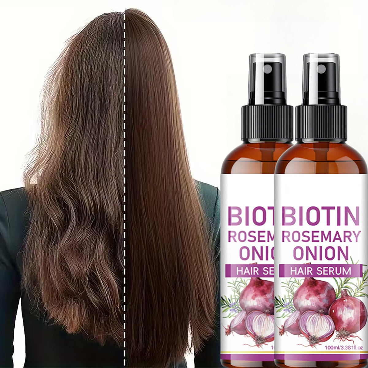 Yniquet 2PCS Onion Hair Growth Serum for Scalp & Hair Care, Onion Hair Care Spray for Hydrating, Onion & Rosemary Hair Growth Oil for Thinning Breakage 3.38 FL OZ (100ML)