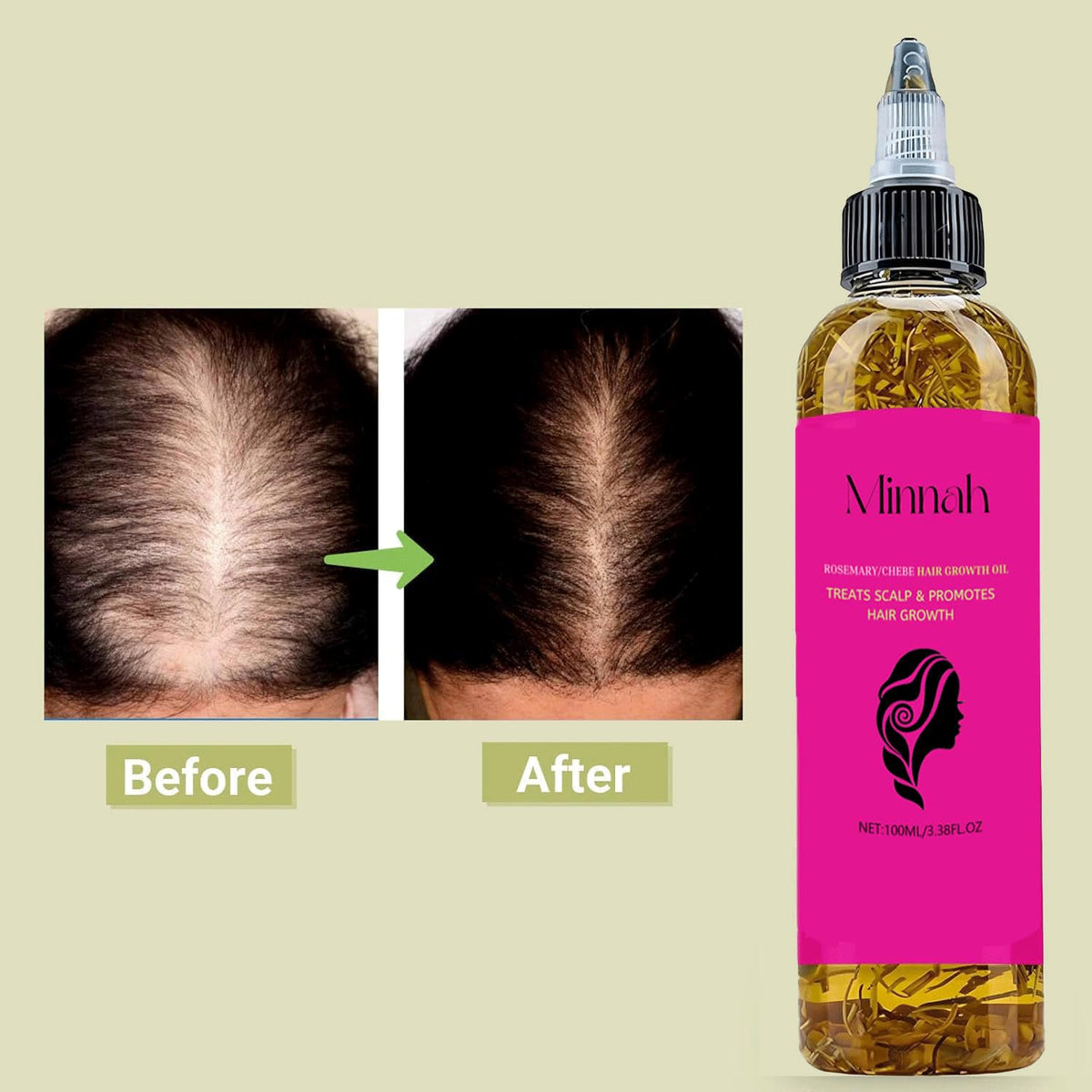 Minnah Batana Oil for Hair Growth 4-in-1 Liquid, 1pcs