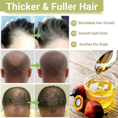 Lifewitqueenp Queenp Ayurvedic Hair Growth Oil, 1pcs