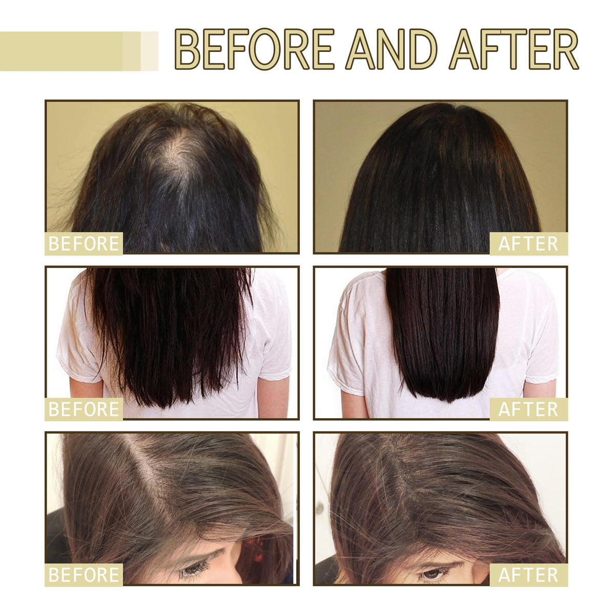 2 Pcs Natural Hair Growth Oil, EELHOE Organic Rosemary Oil for Dry Damaged and Thin Hair.