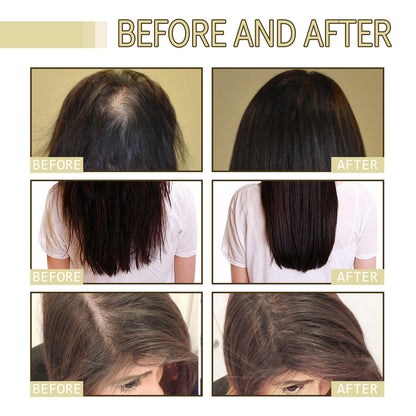 2 Pcs Natural Hair Growth Oil, EELHOE Organic Rosemary Oil for Dry Damaged and Thin Hair.
