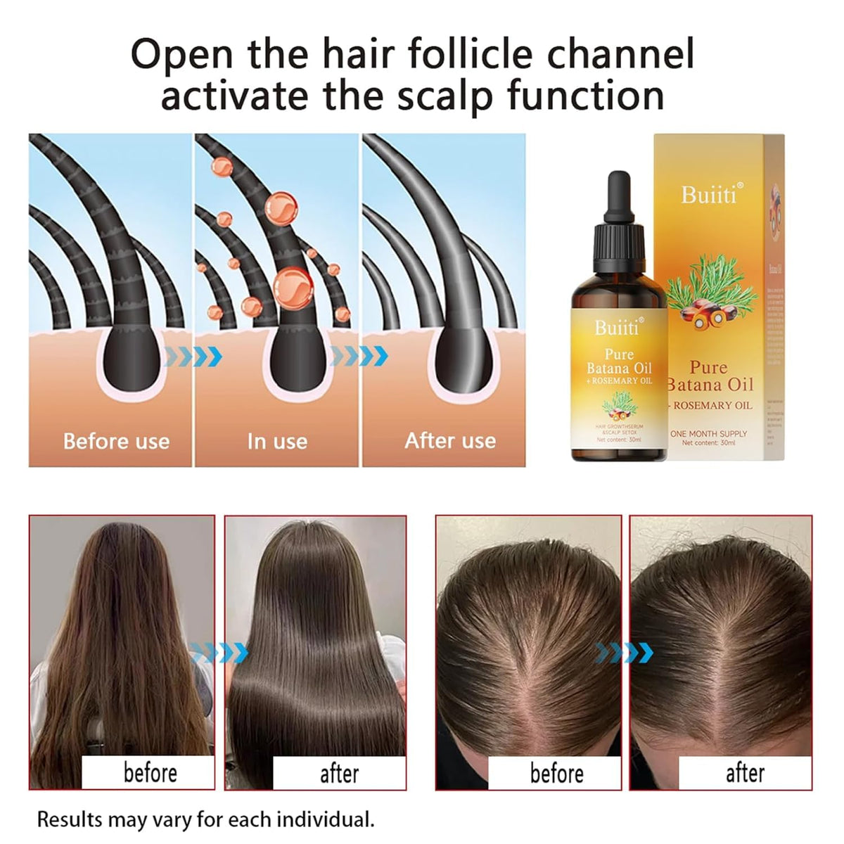 Buiiti Batana Oil with Rosemary for Hair Growth, Organic Hair Treatment for Thinning Hair, Scalp Nourishing, Strengthen & Moisturize Dry Damaged Hair, 1 fl oz