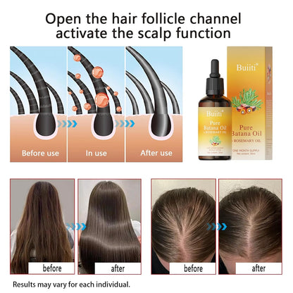 Buiiti Batana Oil with Rosemary for Hair Growth, Organic Hair Treatment for Thinning Hair, Scalp Nourishing, Strengthen & Moisturize Dry Damaged Hair, 1 fl oz