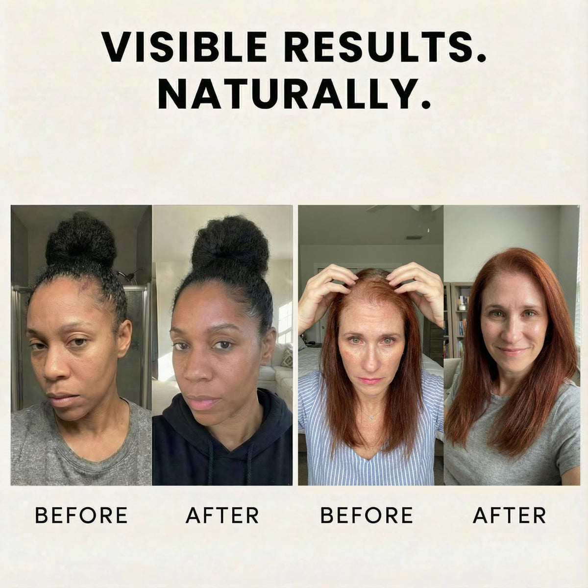Veganic Natural Hair Growth Oil - Plant Based Vegan Formula, 11 Cold-Pressed Oils including Rosemary & Castor, Scalp Treatment for Reduced Shedding, hair oil for dry hair, Damaged & Split End (2 Oz)