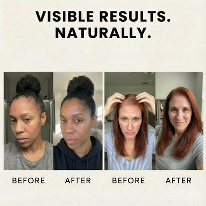 Veganic Natural Hair Growth Oil - Plant Based Vegan Formula, 11 Cold-Pressed Oils including Rosemary & Castor, Scalp Treatment for Reduced Shedding, hair oil for dry hair, Damaged & Split End (2 Oz)