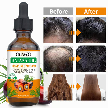 2 Pack Batana Oil for Hair Growth