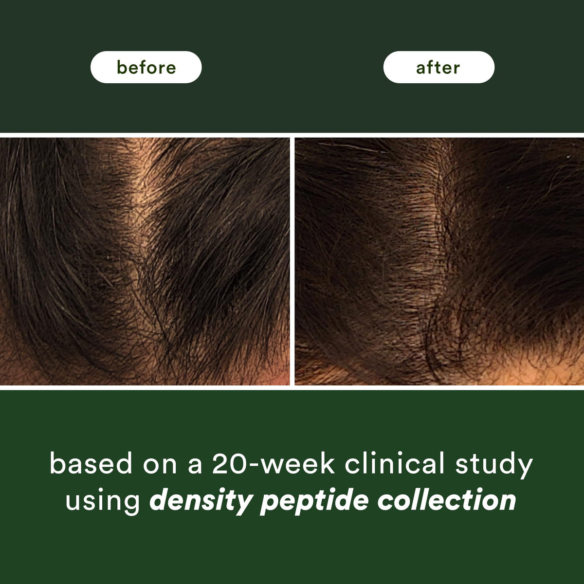 VERB Density Peptide Serum, 1 fl oz - Visibly Thicken + Reduce Signs of Shedding- No Parabens or Harmful Sulfates (Pack of 3)