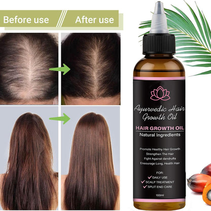 Lifewitqueenp Queenp Ayurvedic Hair Growth Oil, 1pcs