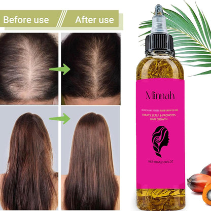 Minnah Batana Oil for Hair Growth 4-in-1 Liquid, 1pcs