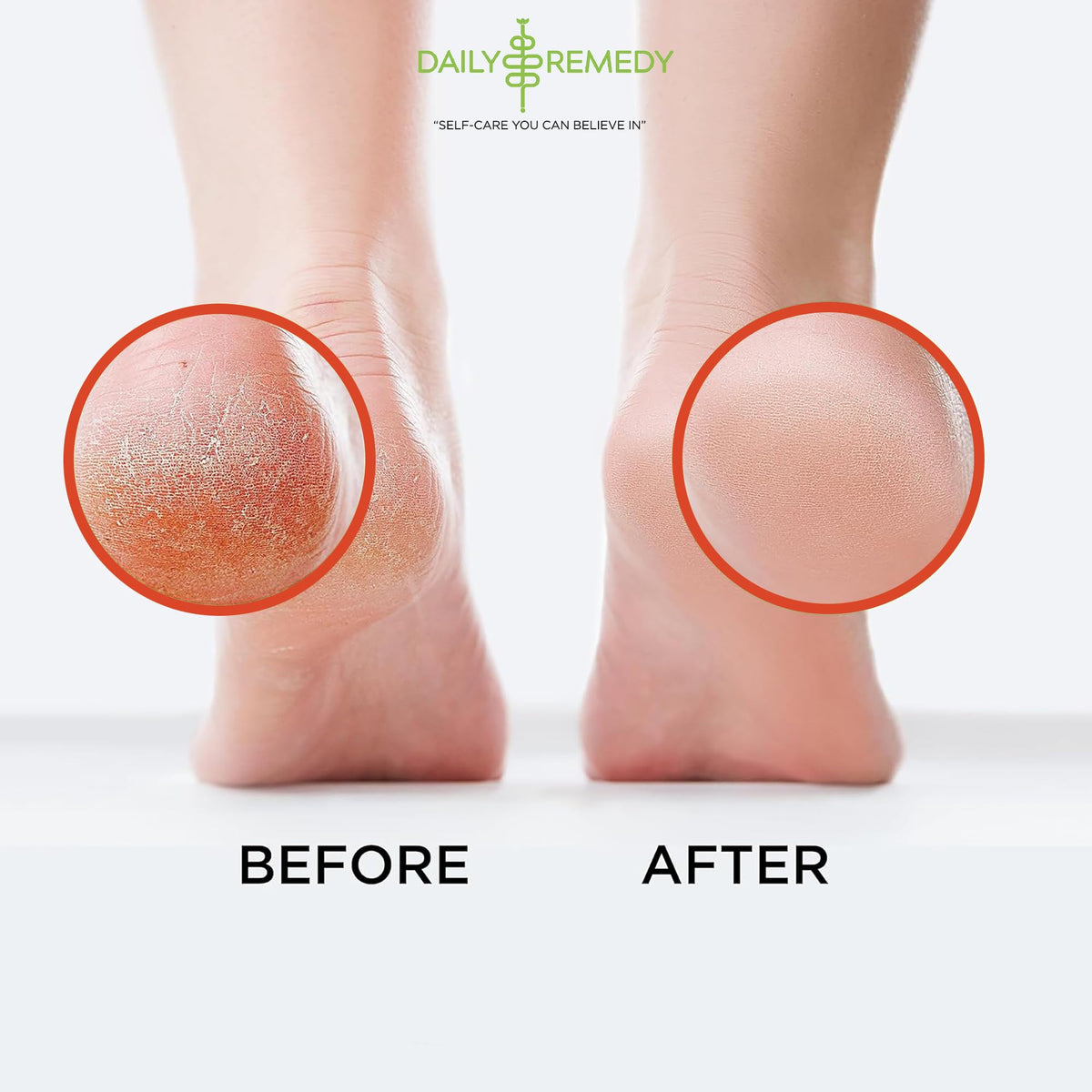 Muscle Relief Foot Soak with Epsom Salt, Made in USA, Soothe Foot Aches, Muscle Pain