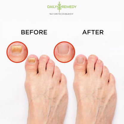 Muscle Relief Foot Soak with Epsom Salt, Made in USA, Soothe Foot Aches, Muscle Pain