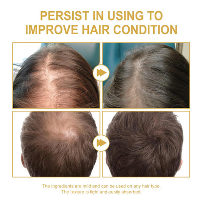 2 Pcs Natural Hair Growth Oil, EELHOE Organic Rosemary Oil for Dry Damaged and Thin Hair.