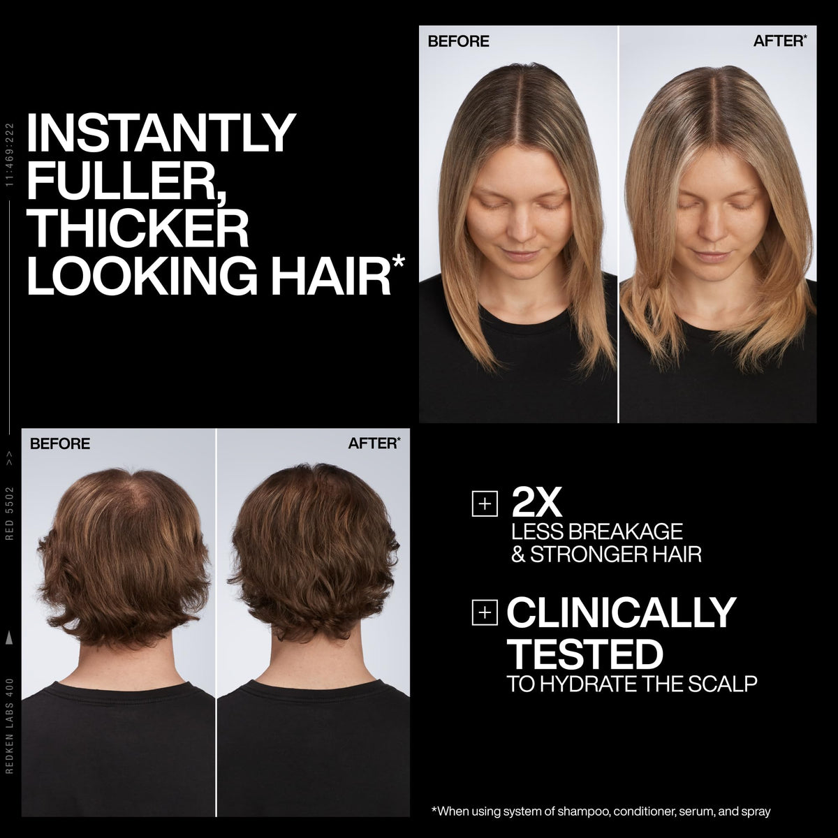 Redken Acidic Grow Full System Scalp & Hair Serum - Lightweight Leave-In Treatment for Rebalanced, Healthy-Looking Scalp and Fuller, Thicker Hair, With Azelaic Acid, 1.5 Fl Oz