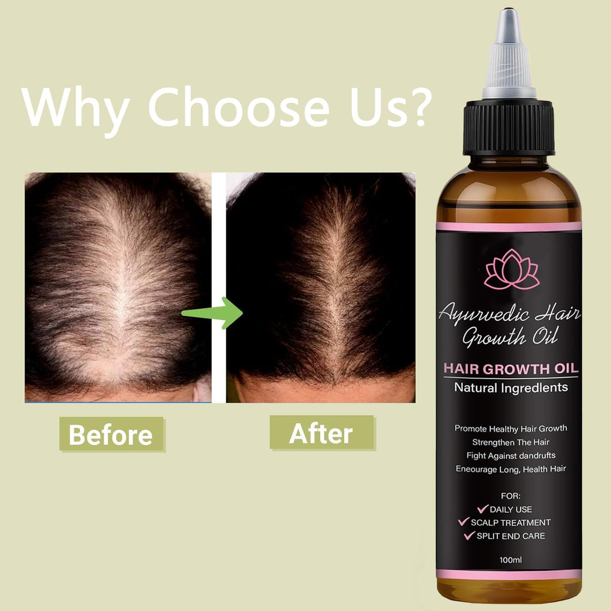 Lifewitqueenp Queenp Ayurvedic Hair Growth Oil, 1pcs