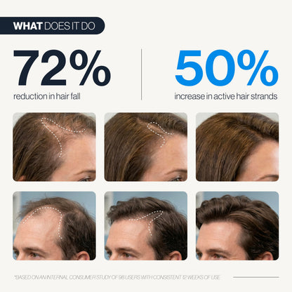 Be Bodywise Hair Growth Serum Roll On - 5% Saw Palmetto, 3% Rosemary Oil for Hair Growth, 3% Fenugreek,1% Caffeine Herbasome - Serum for Hair Loss & Hair Regrowth For Men & Women 25ml/0.84 fl oz