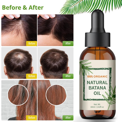 Batana Oil for Hair Growth - Dr Sebi Honduran Hair Oil for Thicker, Stronger Hair, Repairs Split Ends & Dry Scalp, Supports Hair Regrowth for Men & Women, Natural Hair Moisturizer (2.02 fl oz)