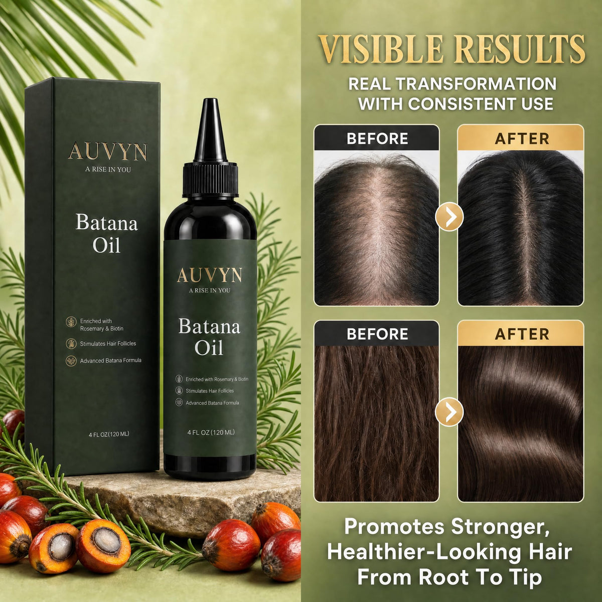 AUVYN Batana Oil for Hair Growth, Premium Scalp Treatment with Rosemary & Biotin, Hair Serum for Thicker, Stronger & Shinier Hair, Men & Women, 4 Fl Oz