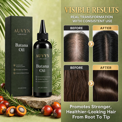 AUVYN Batana Oil for Hair Growth, Premium Scalp Treatment with Rosemary & Biotin, Hair Serum for Thicker, Stronger & Shinier Hair, Men & Women, 4 Fl Oz