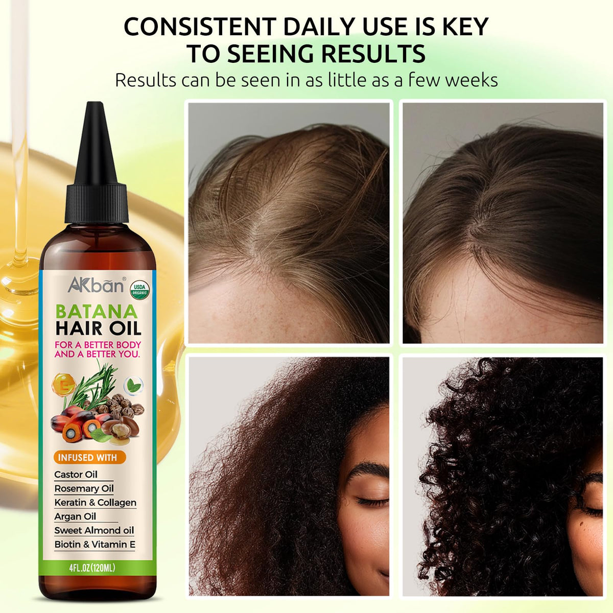 AKBAN Blend of Pure Batana Oil for Hair Growth With Castor, Rosemary, Infused With Biotin, Keratin & Vitamin E, Blend of Effective Hair Oils for Hair Growth-Strengthening Treatment for Healthy Hair