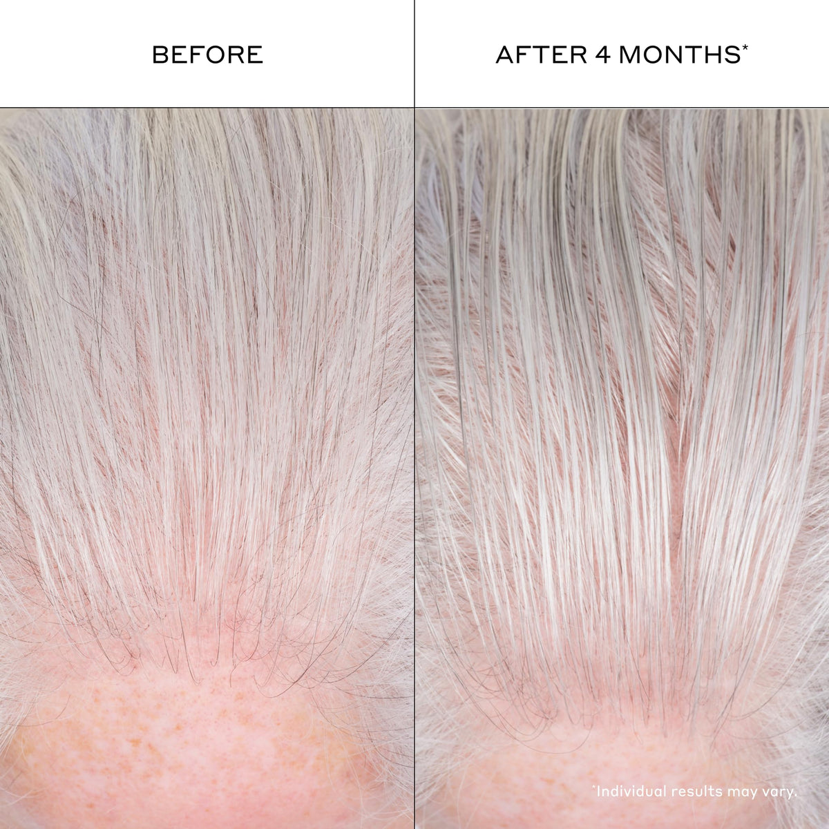 ZENAGEN Densifying Hair Serum for Fine + Thinning Hair - Boosts Hair Density, Strengthens & Nourishes Hair Follicles, Non-Greasy Water-Based Formula, Plant-Based, Vegan, All Hair Types, 1 oz