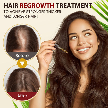 Bofuoos Raw Batana Oil for Hair Growth, 100% Natural Organic from Honduras