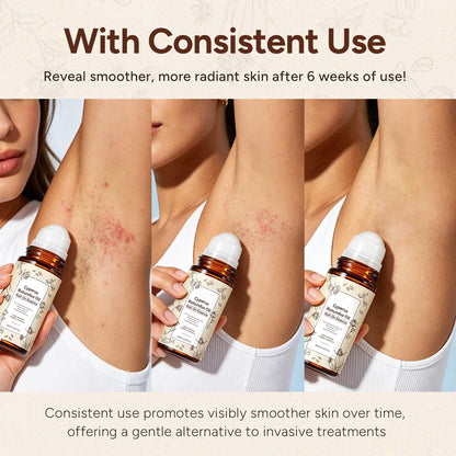 Cyperus Rotundus Oil Roll-on Essence, Cypress Rotundus Oil for Hair Removal, Natural Inhibitor to Reduce Unwanted Hair Growth, Soothes Skin & Minimizes Pores, 2.02 Fl Oz