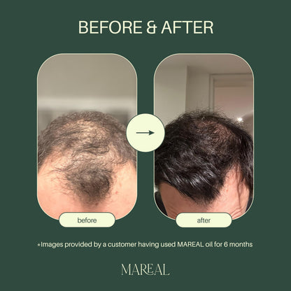 MAREAL Pure Rosemary Oil for Hair Growth & Scalp Health - Infused with Castor & Coconut Oil - Hair Thickening & Regrowth Treatment for Women & Men - 100% Natural - Up to 2-Month Supply - 1.7 fl oz