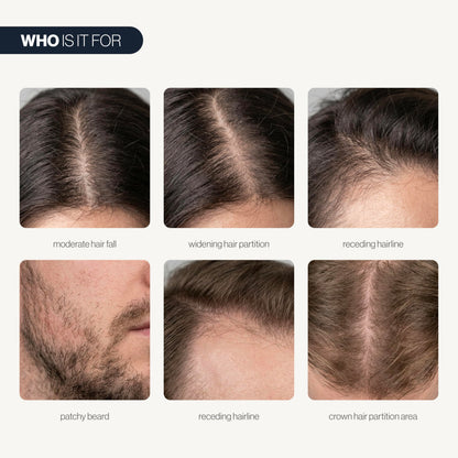 Be Bodywise Hair Growth Serum Roll On - 5% Saw Palmetto, 3% Rosemary Oil for Hair Growth, 3% Fenugreek,1% Caffeine Herbasome - Serum for Hair Loss & Hair Regrowth For Men & Women 25ml/0.84 fl oz
