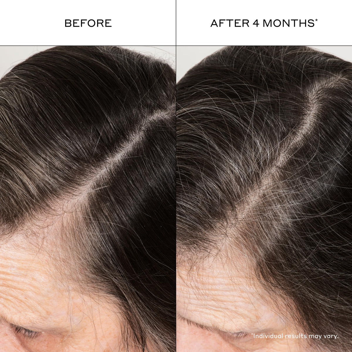 ZENAGEN Densifying Hair Serum for Fine + Thinning Hair - Boosts Hair Density, Strengthens & Nourishes Hair Follicles, Non-Greasy Water-Based Formula, Plant-Based, Vegan, All Hair Types, 1 oz