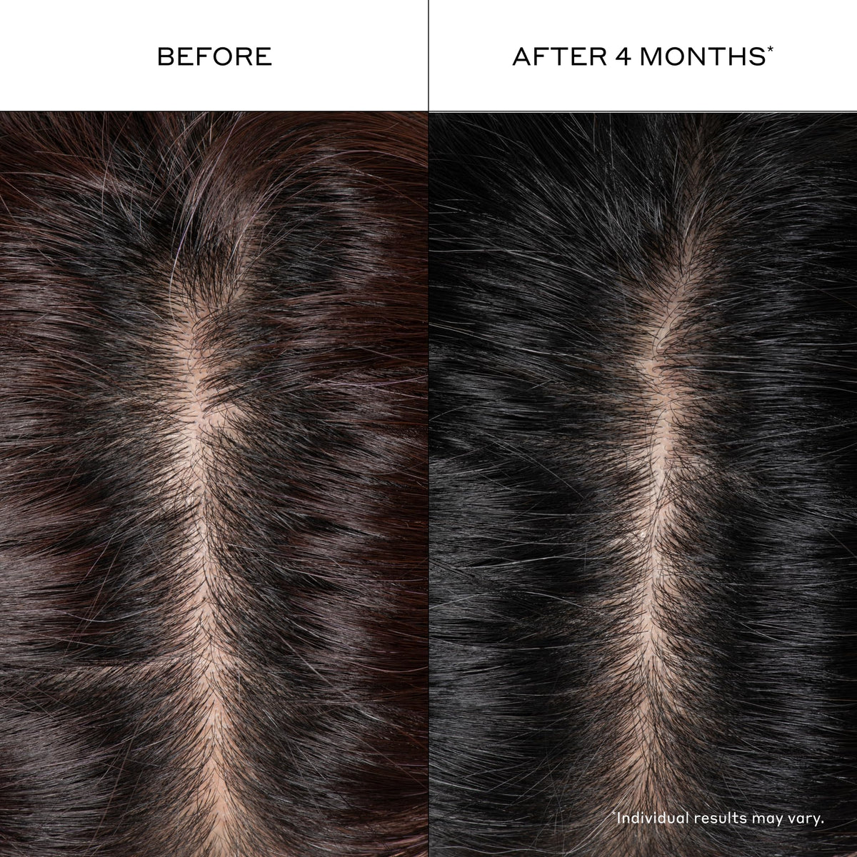 ZENAGEN Densifying Hair Serum for Fine + Thinning Hair - Boosts Hair Density, Strengthens & Nourishes Hair Follicles, Non-Greasy Water-Based Formula, Plant-Based, Vegan, All Hair Types, 1 oz